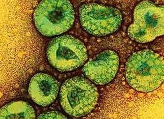 H7N9流感病毒并不等于H7N9禽流感病毒